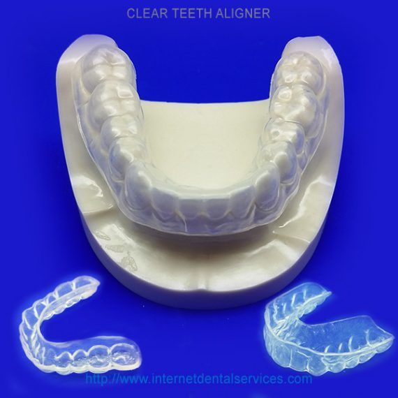 Easy Retainer